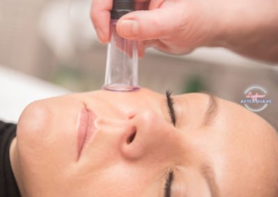 dmGlow treatment facial cupping lipgloss and aftershave