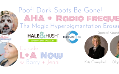 Poof! Dark Spots Be Gone: AHA Treatment + Radio Frequency: The Magic Hyperpigmentation Eraser