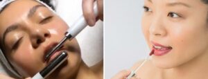 lip plumping treatment