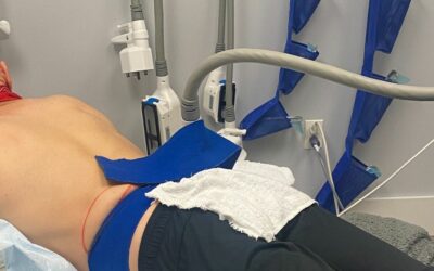 Unbiased Coolsculpting Results For Love Handles