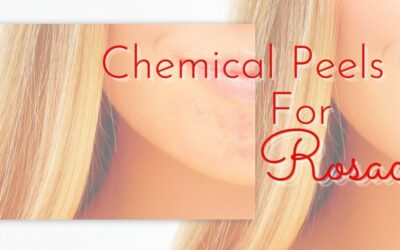 Experts Weigh In On Top 8 Chemical Peels For Rosacea