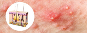 congested skin