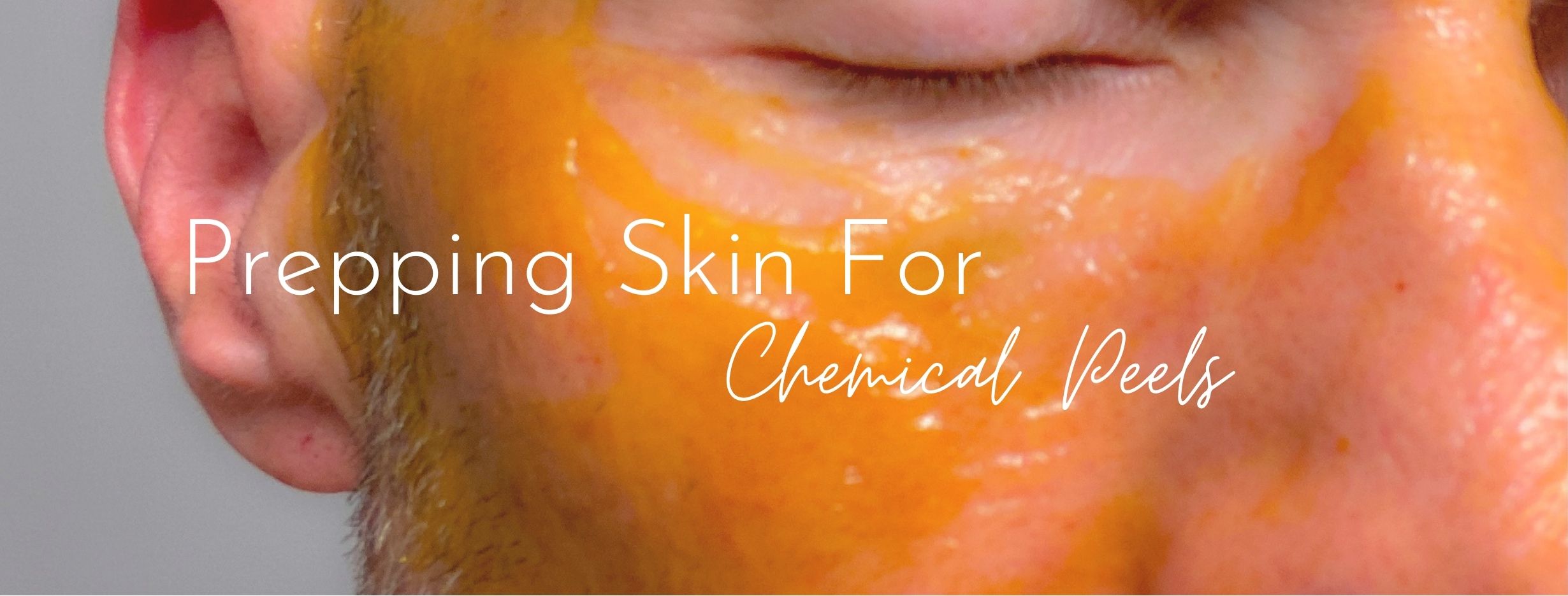 Professional + Home Care To Prep The Skin For Deep Peels