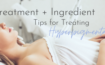 Treatment + Ingredient Tips for Treating Hyperpigmentation