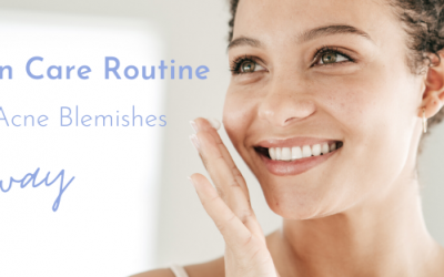 Daily Skin Care Routine To Keep Acne Blemishes Away