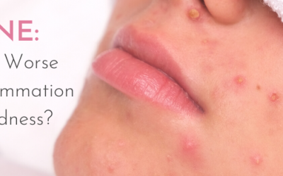 ACNE: What’s Worse the Inflammation or Redness?