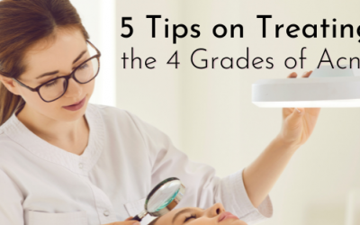 5 Tips On Treating the 4 Grades Of Acne