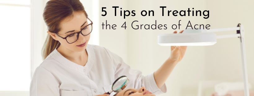 5 Tips On Treating the 4 Grades Of Acne
