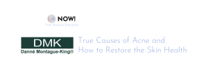 True Causes of Acne and How to Restore the Skin Health