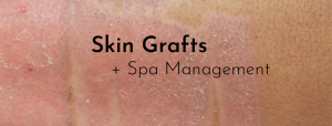 Skin Grafts
