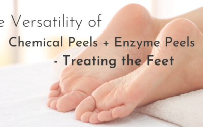 The Versatility of Chemical Peels + Enzyme Peels – Treating the Feet