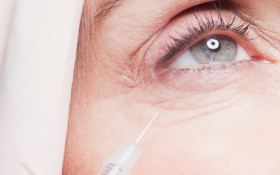 Botox + Fillers During Conventional Cancer Treatment