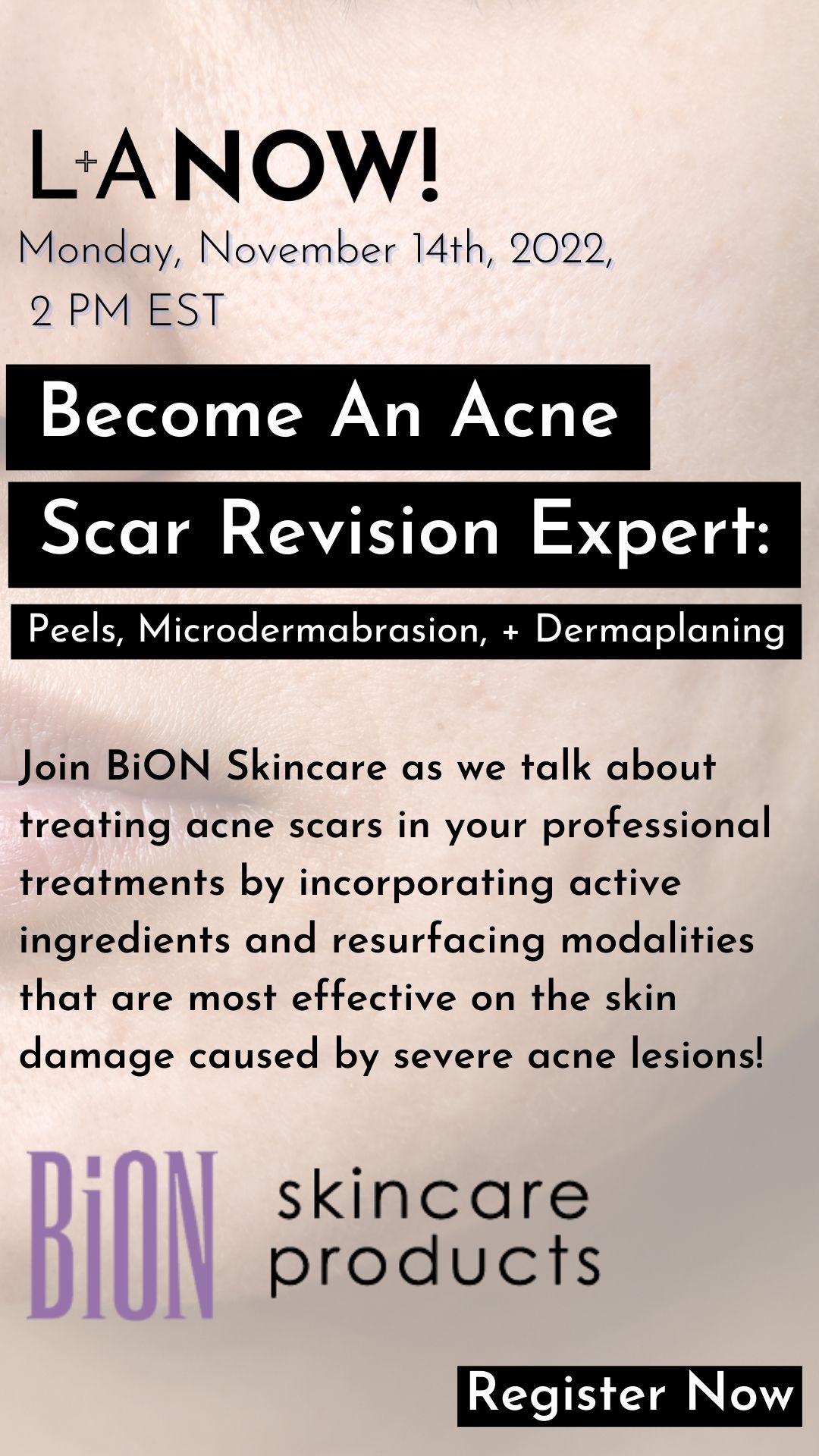acne scar revision