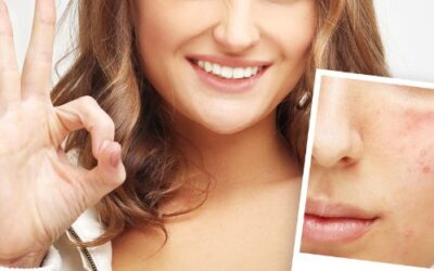 Learn How Face Reality Treats Acne