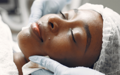 The Art of Skin Conditioning Using Chemical Peels