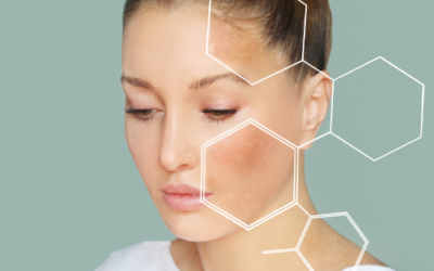 Elevate Your Skincare Business: Take M.A.D Mapping® to the Next Level