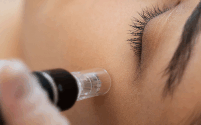 What Are Defensins? – If you Do Peels, Needling or Laser Treatments – This is an Ingredient You Need to Know