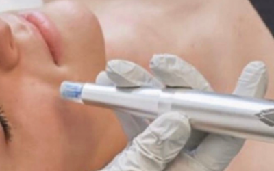 No More Needles: The Rise of Non-Inflammatory Performance Treatments