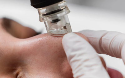 No Medical Director. No Problem: 3 High-Performance Treatments Estheticians Are Using to Drive Serious Revenue