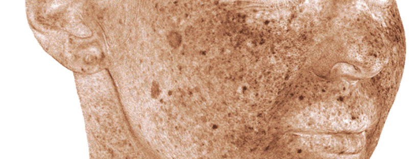 Turn Your Consults into Conversions Faster with Canfield’s NEW VISIA® Skin Analysis – Now in 3D!