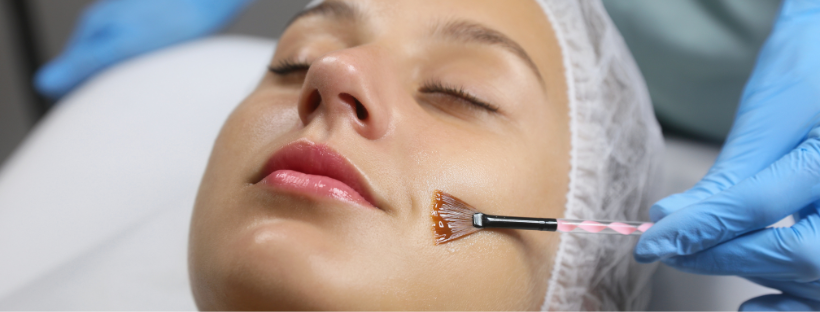 Discover the Double Peel: A New Approach to Acne & Pigmentation