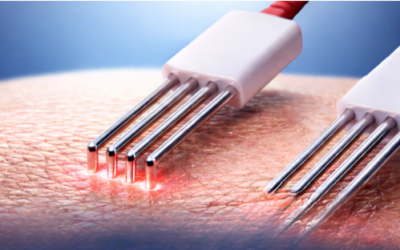Why Microcurrent Is Leading the Charge In Regenerative Aesthetics