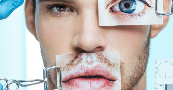 Beyond the Surface: The Role of Body Dysmorphic Disorder and Psychodermatology in Aesthetic and Plastic Surgery