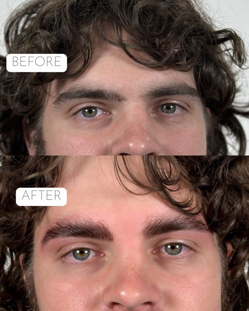 Men’s Aesthetic Treatment