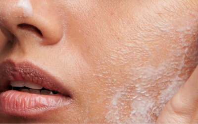 Before You Poke It, Prep It.